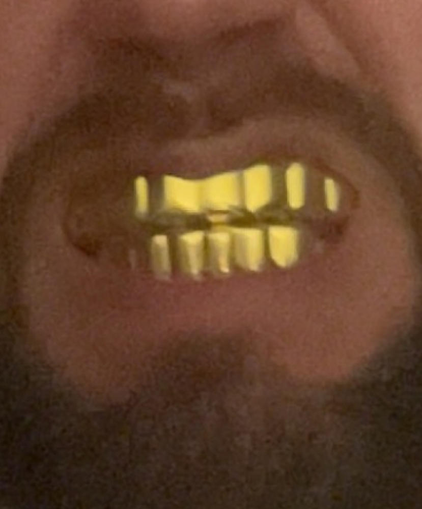 8 Teeth Hip Hop Grillz Bar Gold-Plated Edition - Customer Photo From Brian