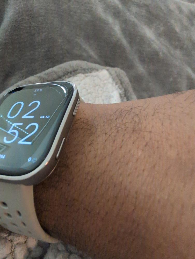 Bip 6 - Customer Photo From Anonymous