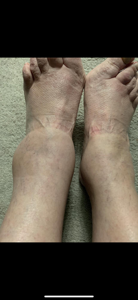 Kala Red Light Pro - Customer Photo From Christina Hanley