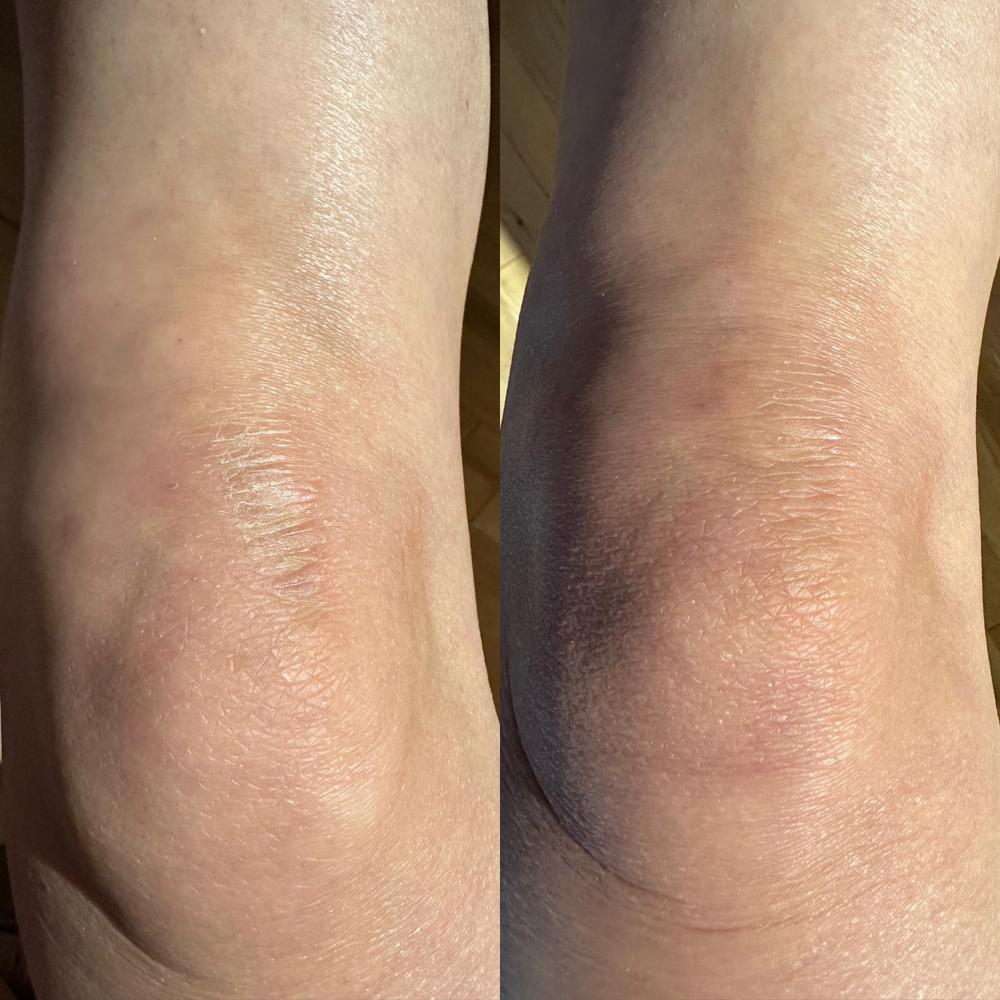 Kala Red Light Pro Panel - Customer Photo From Maxine Klak