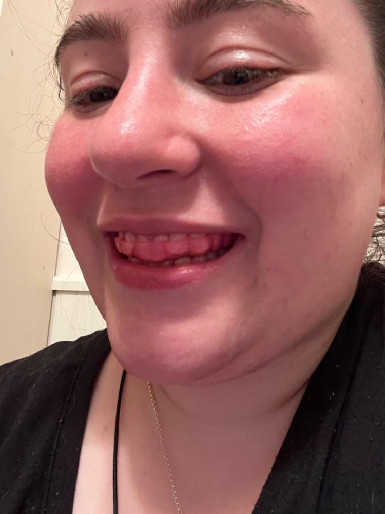 Hybrid Guard - Customer Photo From Melody J. Sonstrom