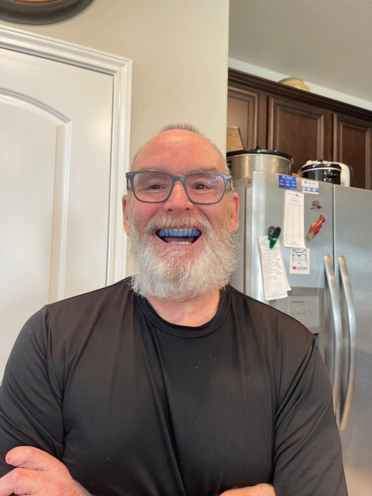 Hybrid Guard - Customer Photo From Dana Dooley