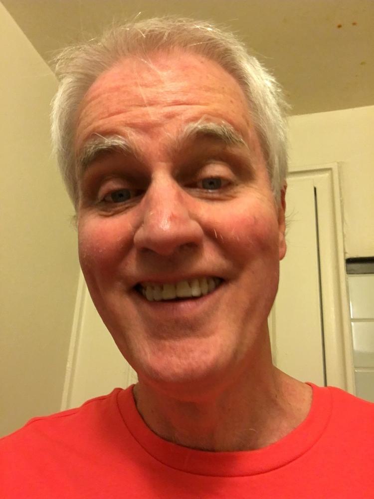 Single Layer Hard - Customer Photo From Lillian Nash