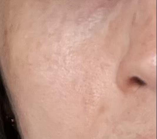 Pure Aloe Vera Gel 300g - Customer Photo From Anonymous
