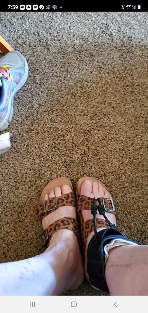 Soft AFO Drop Foot Brace | Shoe Dorsiflexion Assist for Neuropathy or Charcot Marie Tooth Treatment - Customer Photo From Lisa Spurgeon 
