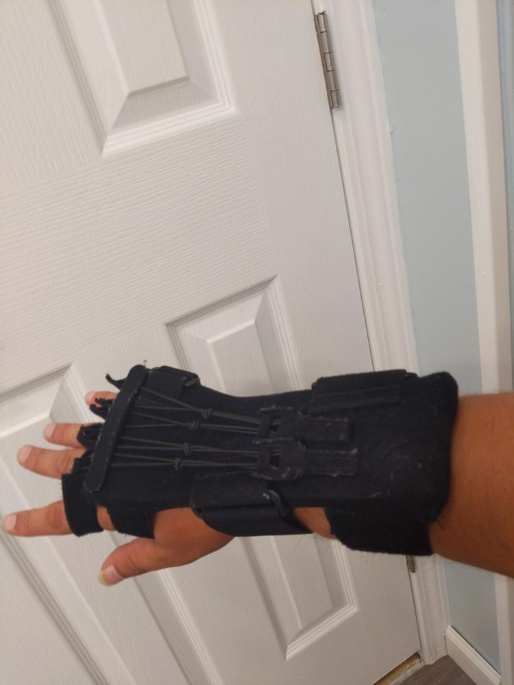 Radial Nerve Palsy Splint | Dynamic Wrist Drop & Finger Extension Brace for Saturday Night, Honeymoon & Crutch Palsy - Customer Photo From Jeff Hunter
