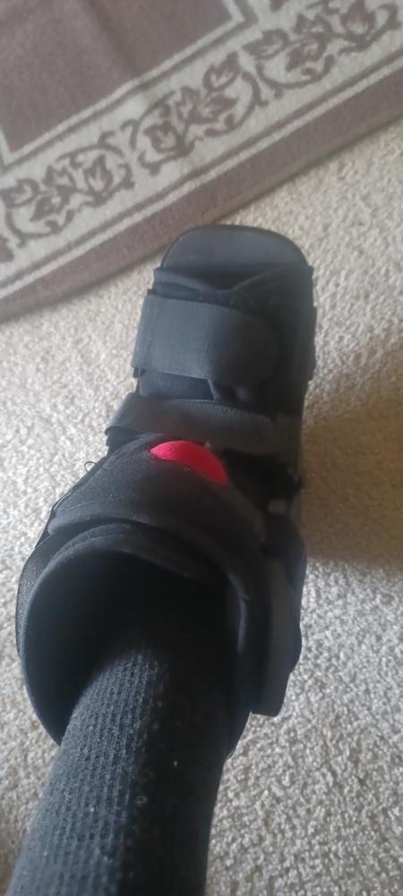 Short Air Medical Walking Boot for Broken / Injured Foot - Customer Photo From Mary S. Dalton