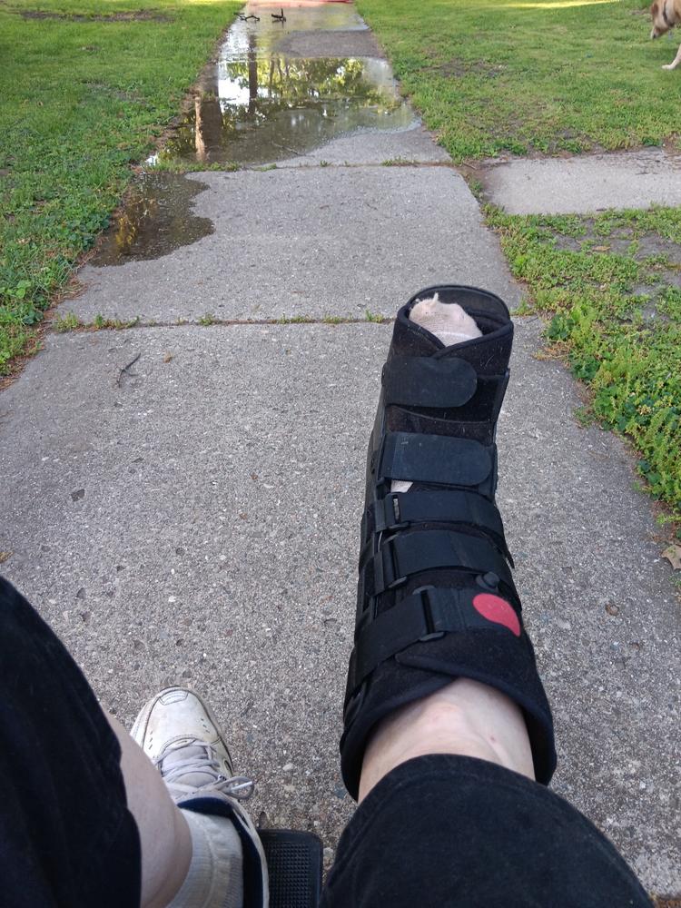 Tall Pneumatic Walking Boot | Orthopedic CAM Air Walker Cast for Broken Foot & Sprained Ankle - Customer Photo From Cary Dipaola