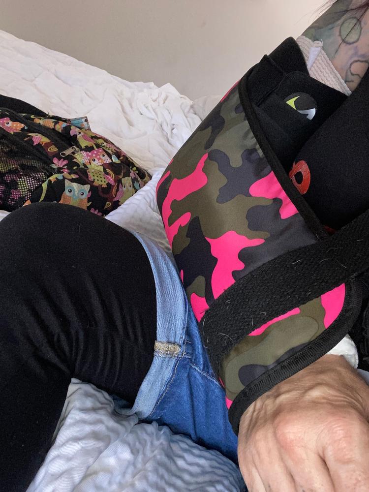 Elbow Fracture Splint | Removable Long Arm Cast & Broken Supracondylar or Proximal Ulna Immobilizer Brace - Customer Photo From Laura 