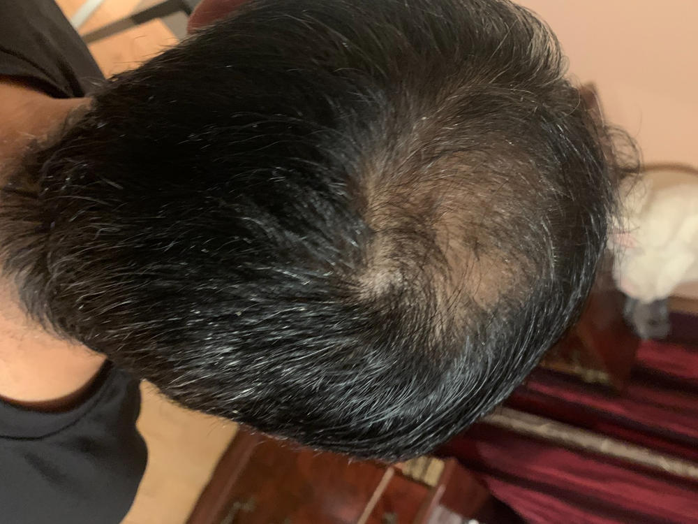 SureThik Hair Thickening Fibers (15g / 0.53oz) - Customer Photo From Noureen Asrani
