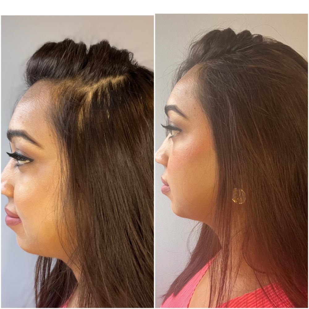 Hair Fiber Starter Package + Application Tools - Customer Photo From Saloni S.