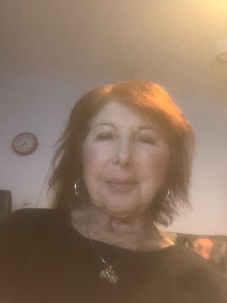 SureThik® Hair Thickening Fibers (30g / 1.06oz) - Customer Photo From Renee Weingard