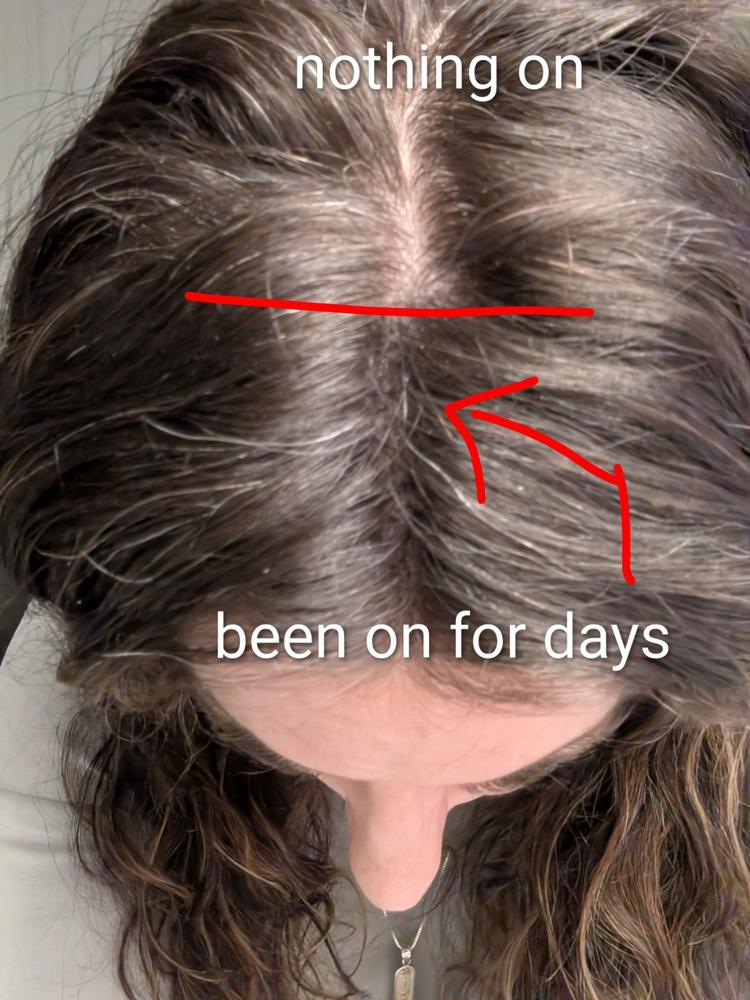 Hair Thickening Fibers 30g - Customer Photo From Joanne Parker