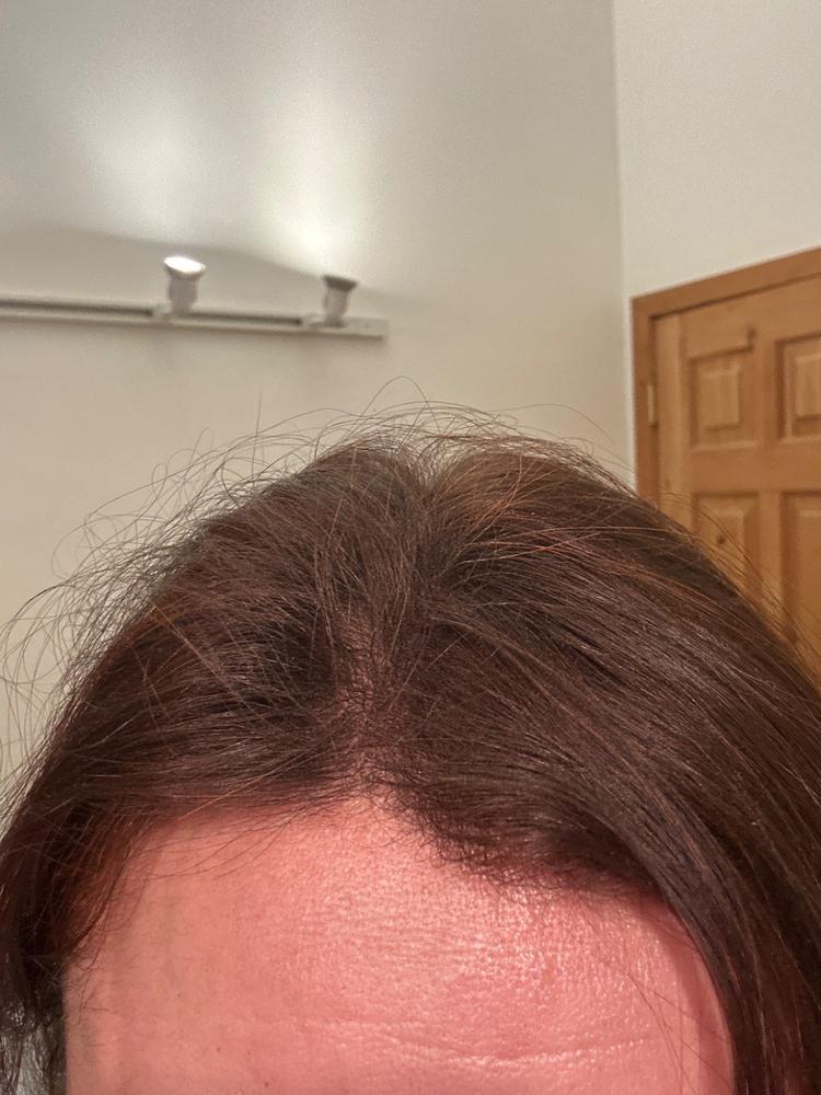 Hair Thickening Fibers 30g - Customer Photo From Mirela Cherciov