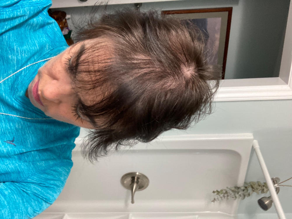 SureThik® Hair Thickening Fibers (30g / 1.06oz) - Customer Photo From Vickie Kalil