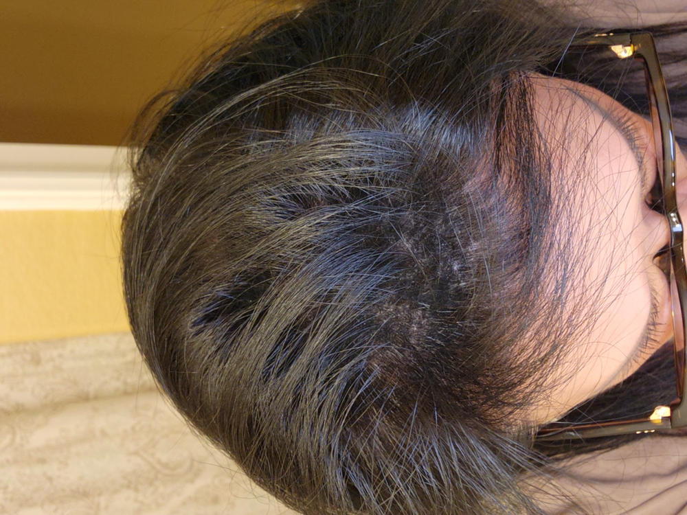 Hair Thickening Fibers (15g / 0.53oz) + FREE Applicator - Customer Photo From Soraya Reinoso