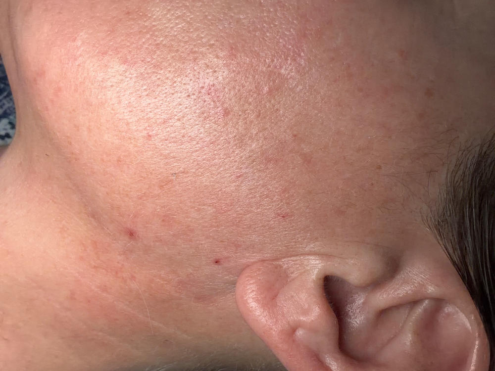 Restoring Face Cream - Customer Photo From eliza renz