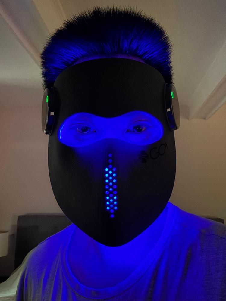 Red-Light Exomask - Customer Photo From Jason Nguyen