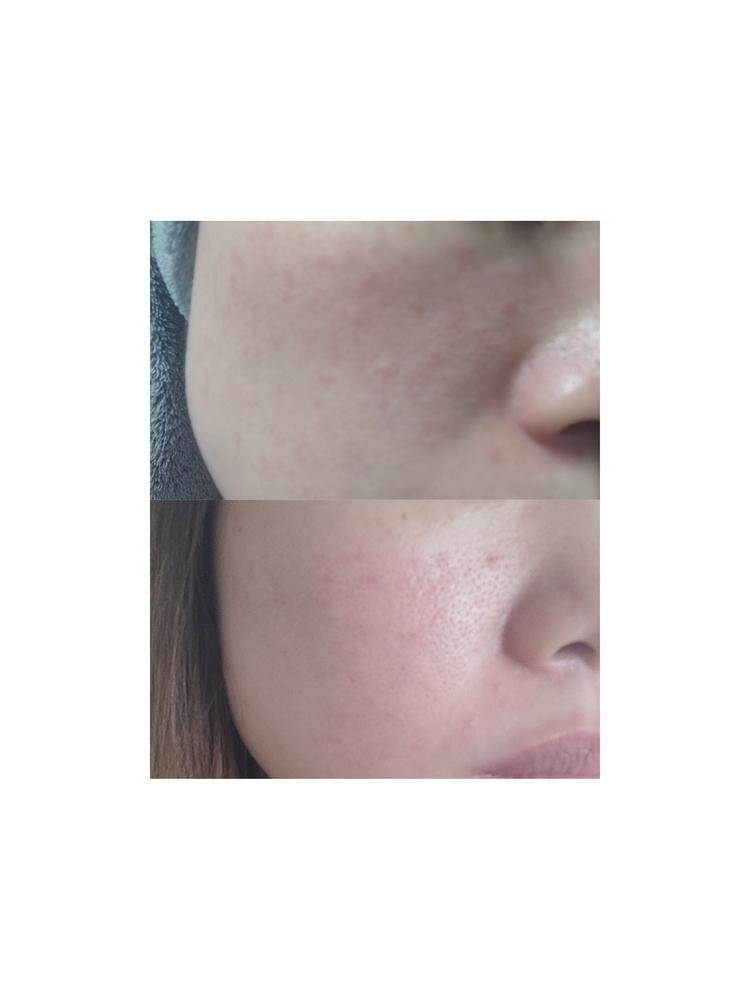 Essello On-Off 6 Cleanser (300ml) - Customer Photo From Jan c.