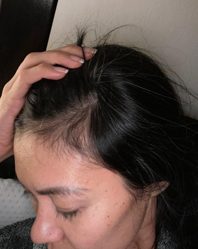 Gray Escape™ Advanced Anti-Gray Hair Growth Supplement - Customer Photo From Cintia Silva