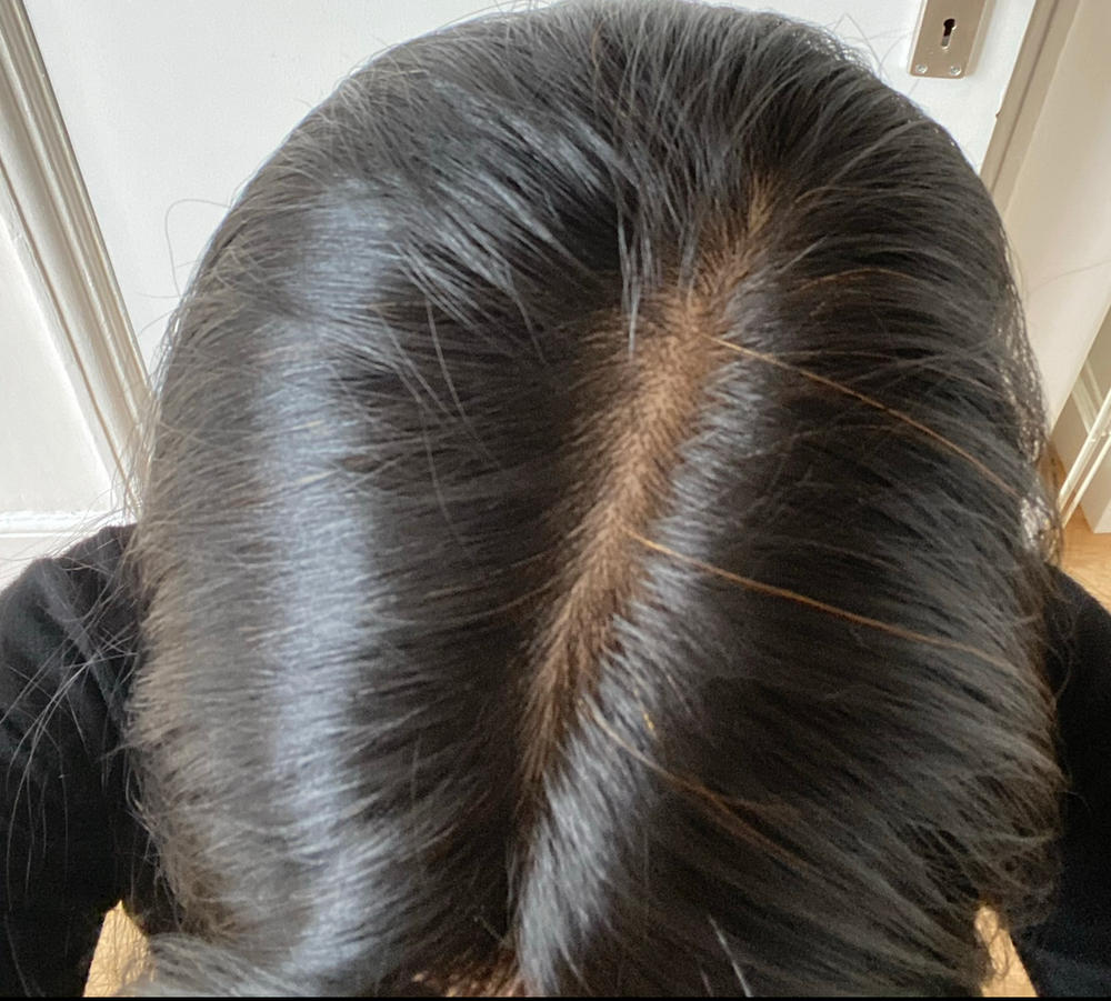 Gray Escape™ Advanced Anti-Gray Hair Growth Supplement - Customer Photo From Cintia Silva