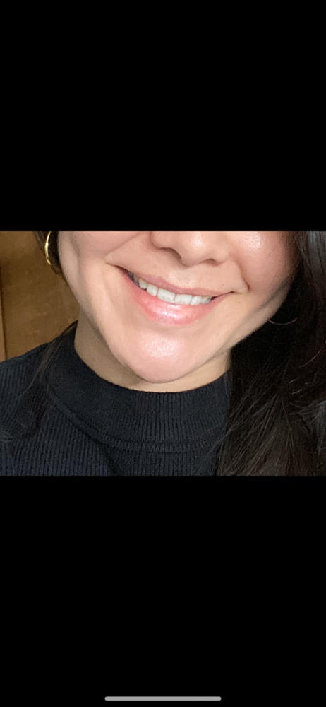 Shine—Remineralizing Tooth Whitening Powder with Hydroxyapatite - Customer Photo From Kayla Matias