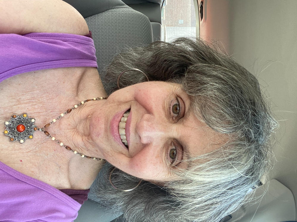 Shine—Remineralizing Tooth Whitening Powder with Hydroxyapatite - Customer Photo From Alice Brickman