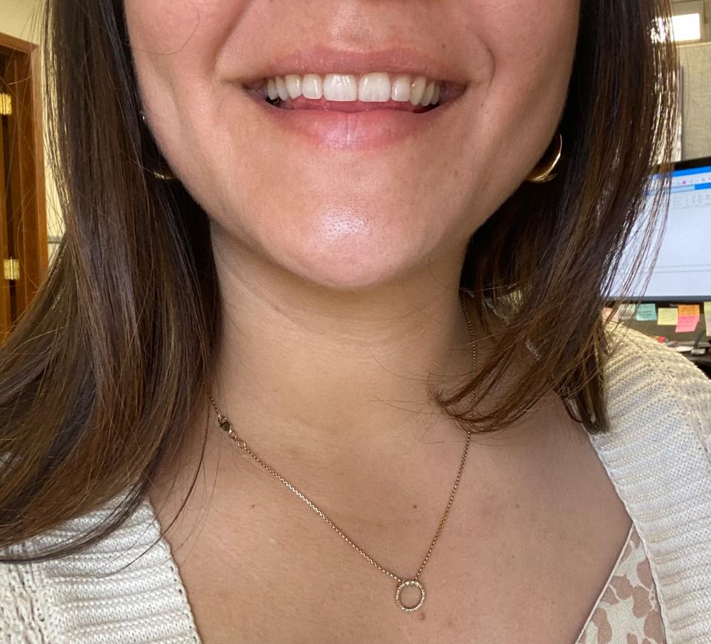 Shine—Remineralizing Tooth Whitening Powder with Hydroxyapatite - Customer Photo From Kayla Matias