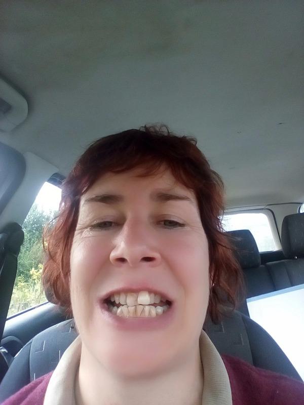 Shine—Remineralizing Tooth Whitening Powder with Hydroxyapatite - Customer Photo From Fiona F.