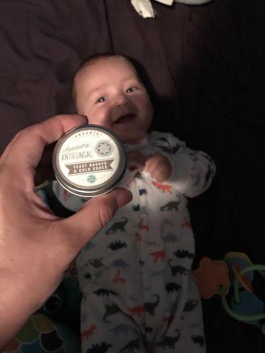 Awesome Salve - Customer Photo From Melissa E.