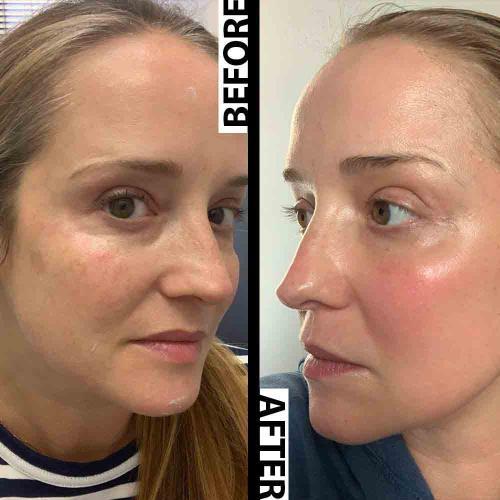 Lanveza LED Beauty Mask - Customer Photo From intelsa