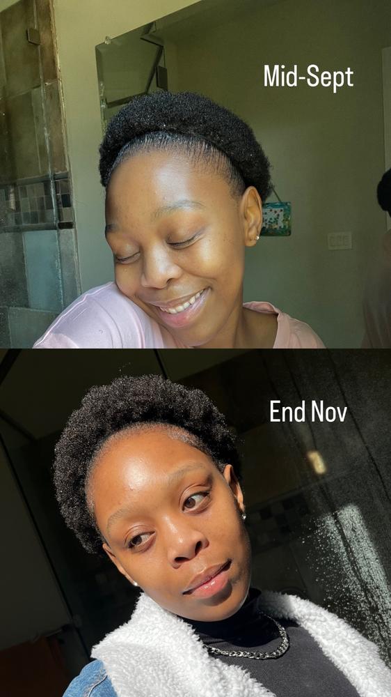Untamed Growth Oil - Customer Photo From Amanda Sithole