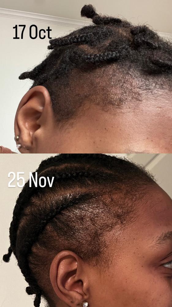 Untamed Growth Oil - Customer Photo From Amanda Sithole