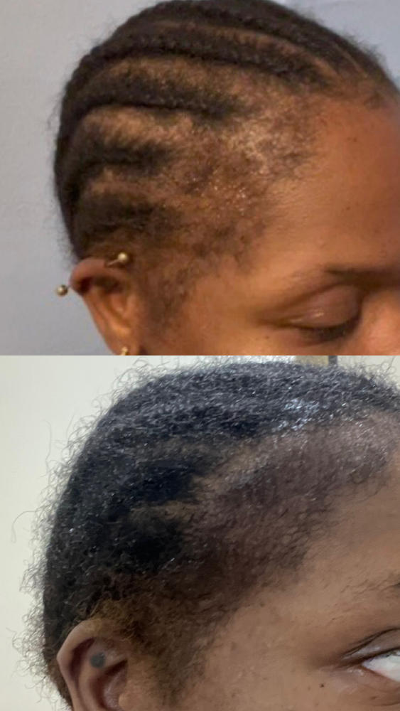 Untamed Growth Oil - Customer Photo From Ijeoma Anozie