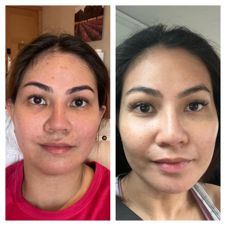 All-In-One Face Serum - Customer Photo From White Caren