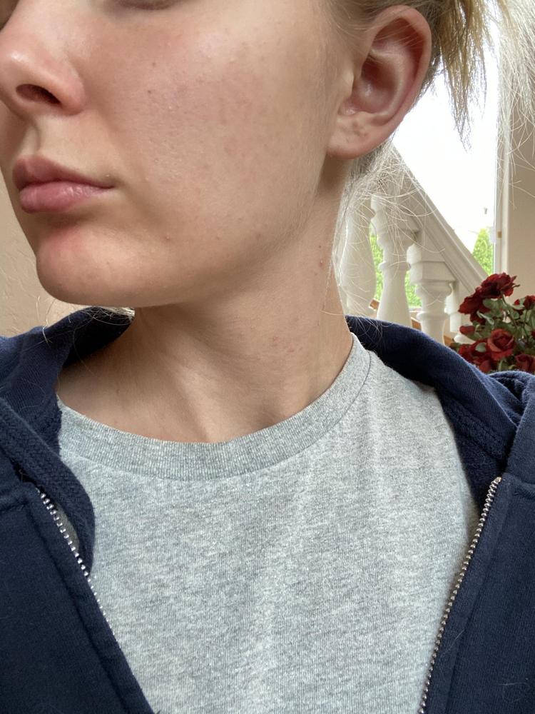 Pressed Foundation - Customer Photo From Iris Vold
