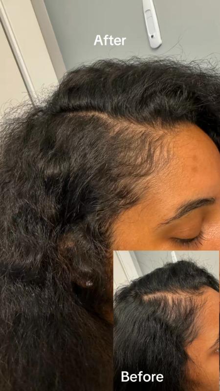 BOOST DUO POD - Customer Photo From Alexis J.