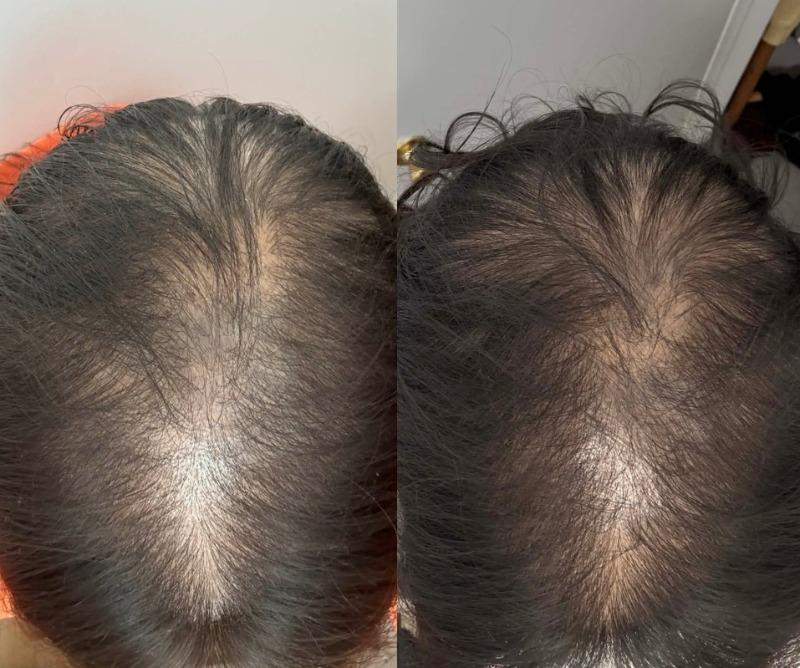 BOOST DUO POD - Customer Photo From Tiffany L.