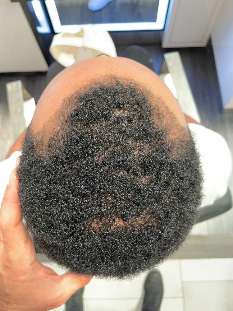 Hairatin Hair Fibers 28 G - Customer Photo From Leo P 