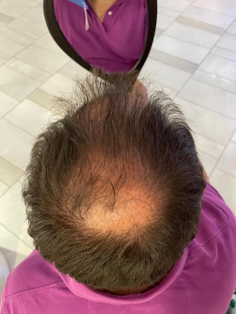 Hairatin Hair Fibers 28 G - Customer Photo From Rick B