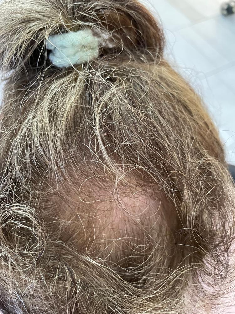 Hairatin Hair Fibers 28 G - Customer Photo From Emma L