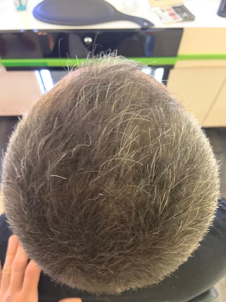 Hairatin Hair Fibers 28 G - Customer Photo From David Slater 