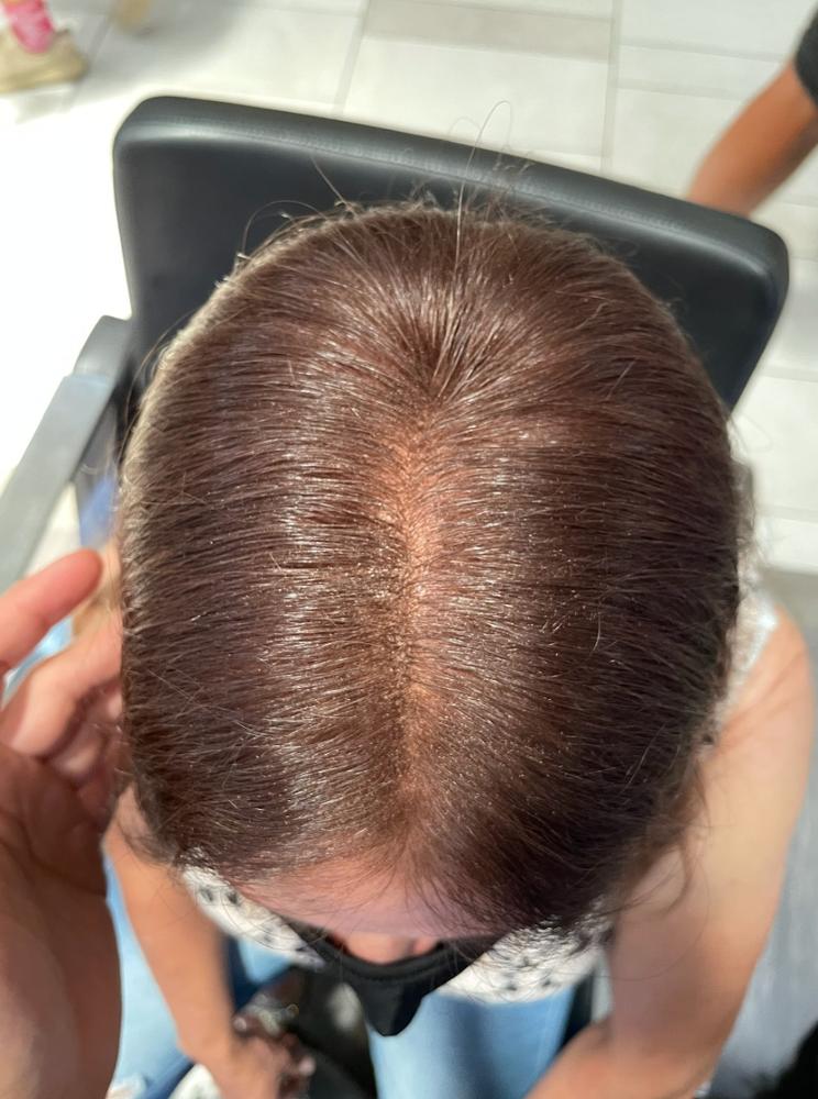 Hairatin Hair Fibers 28 G - Customer Photo From Lynn