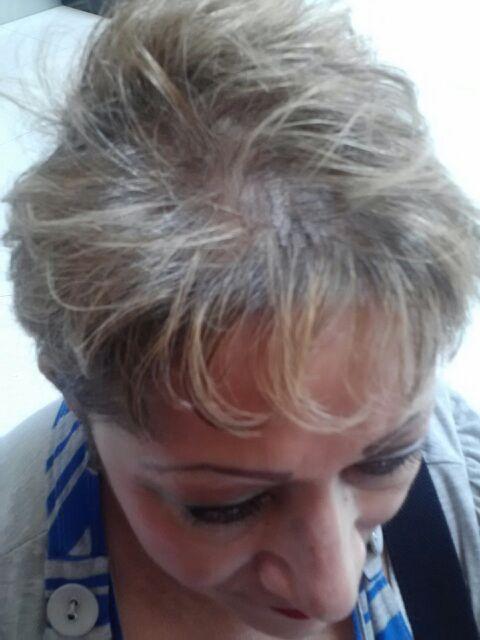 Hairatin Hair Fibers 28 G - Customer Photo From sarah