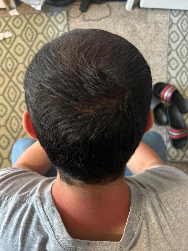 Hairatin Hair Fibers 28 G - Customer Photo From Andrés