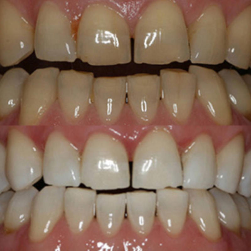 Before & After - 7 Days