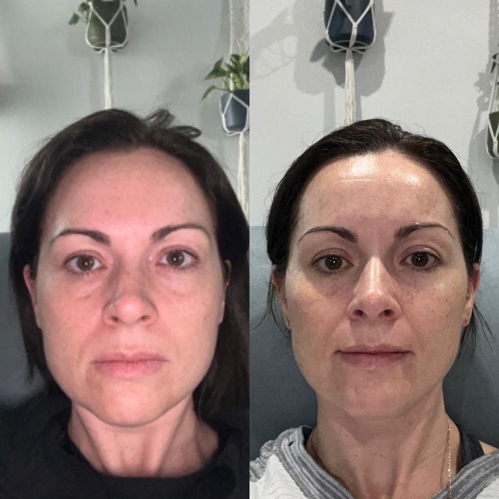 Skin Gym Facial Toner + Free Derma Fill Gel - Customer Photo From Anonymous