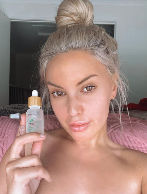 Salicylic Acid Serum - Customer Photo From Jessica B.