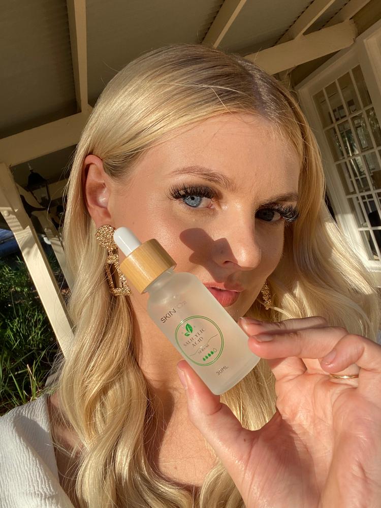 Salicylic Acid Serum - Customer Photo From Cynthia Alley 