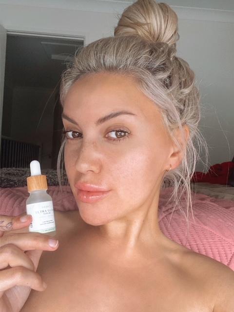 Salicylic Acid Serum - Customer Photo From Jessica B.